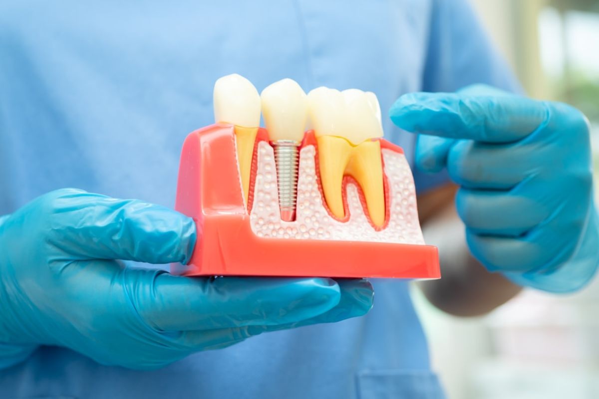 Dental Implants Duxbury Dental Implants Duxbury