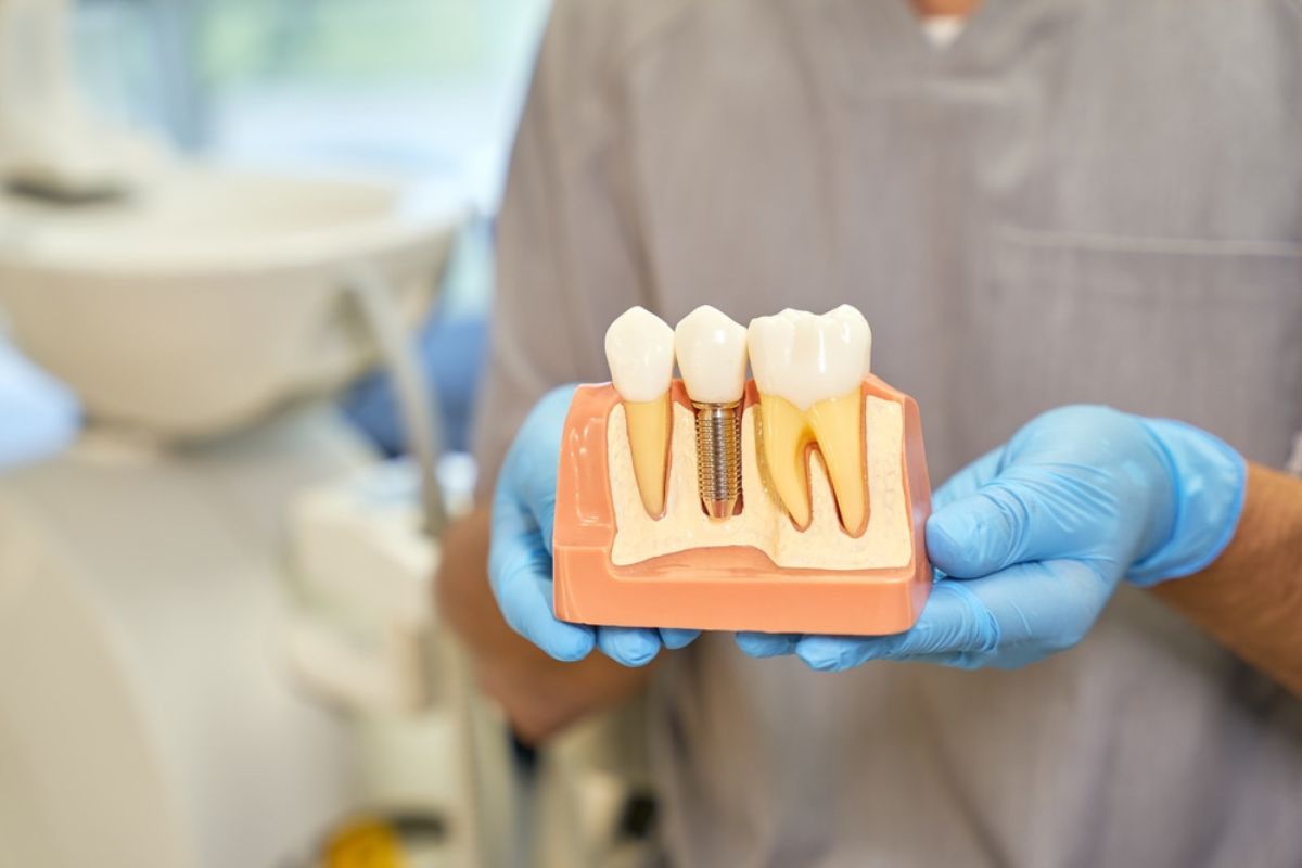 Dental Implant Consultation Dental Implant Consultation