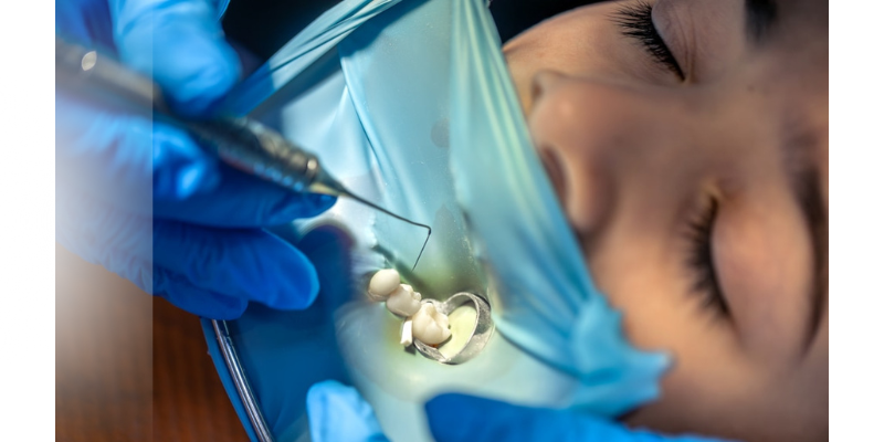 Dental Fillings Types Dental Fillings Types
