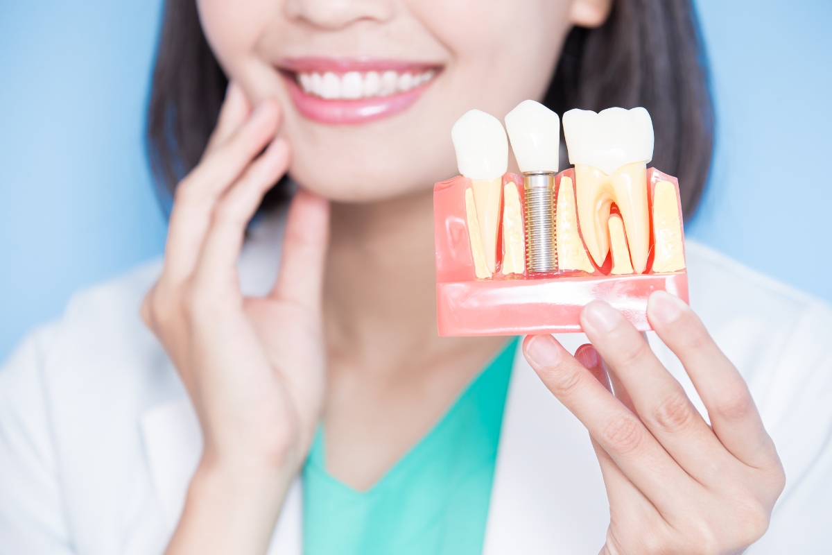 Brighten Your Smile: The Power of Implanting Your Back Tooth Brighten Your Smile: The Power of Implanting Your Back Tooth